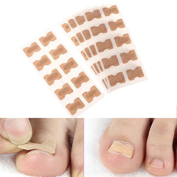 Detailansicht Nagelkorrekturpflaster zur schmerzfreien Behandlung eingewachsener Zehennägel. Fördert gesunde Fußpflege.