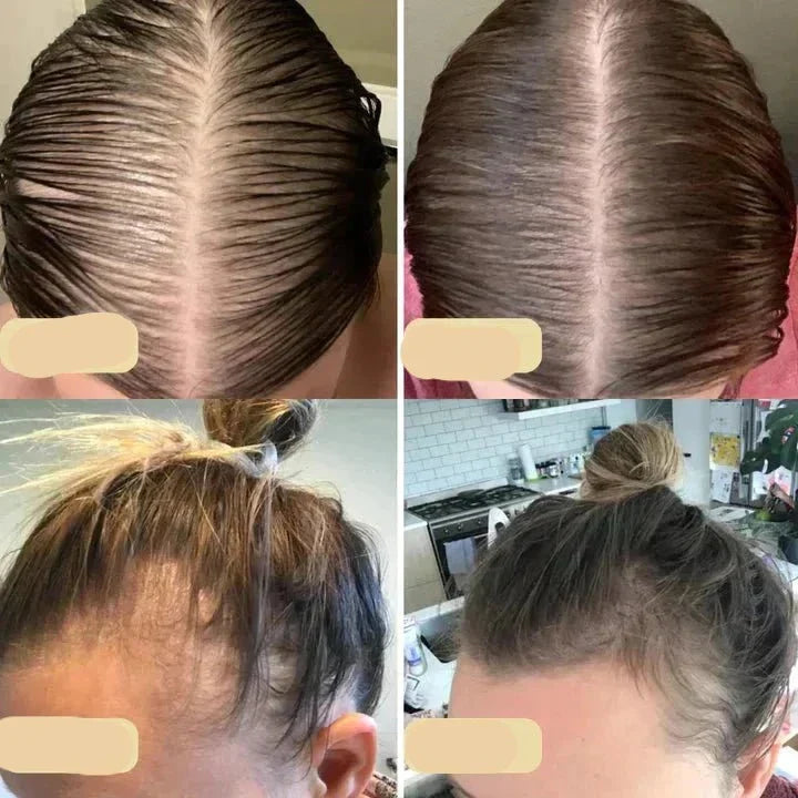 Haarpflege: Eine Hand hält das natürliche Haarwachstumsöl, bereit für Anwendung auf trockenem, brüchigem Haar.