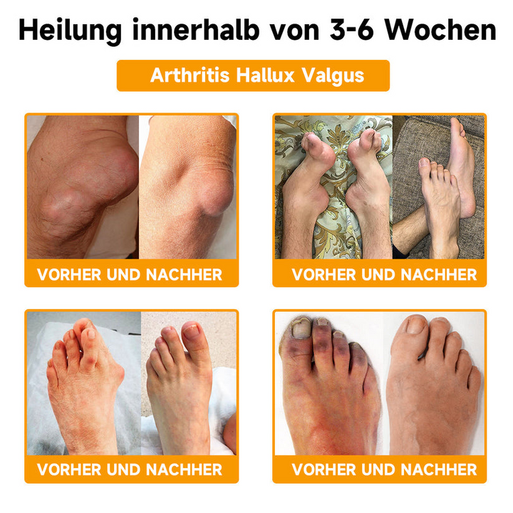 Feuchtigkeitspflege Bienengiftcreme: Hyaluron & Kollagen reduzieren Falten & sorgen für glatte, strahlende Haut.