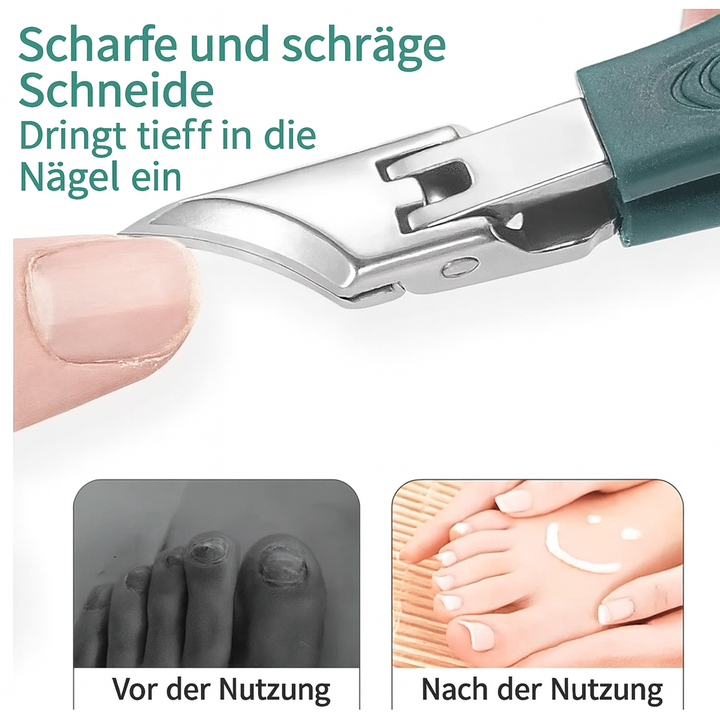 Robuste Nagelzange für eingewachsene & Problemfußnägel; präzise Fuß- & Handpflege Hygiene.