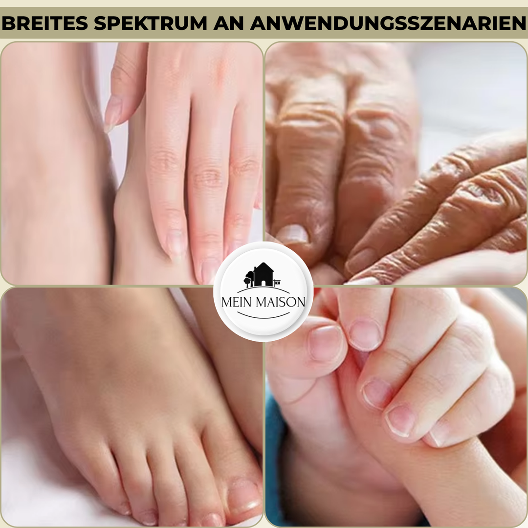 Stabiler Nagelknipser mit breiter Maulöffnung, speziell für dicke und harte Nägel. Mit integriertem Spritzschutz für Sauberkeit.