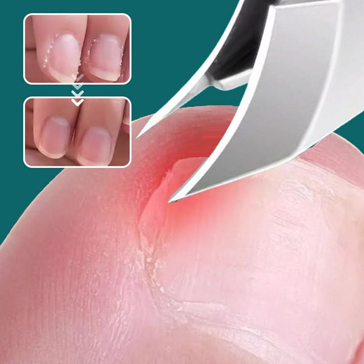 Geschenk: Professionelles Nagelpflegeset aus Edelstahl mit Anti-Spritzschutz für saubere Nägel.