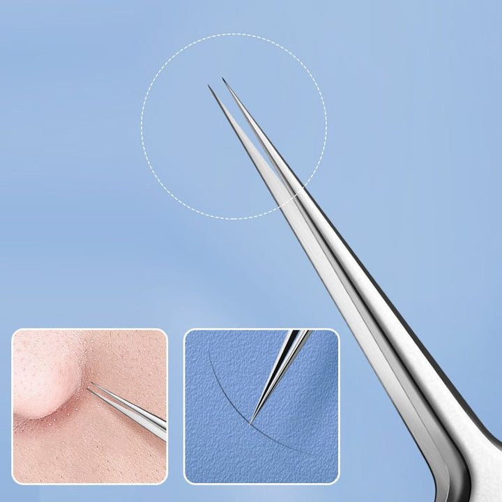 Dermatologisches Edelstahl Pickelentferner Set für sichere & hygienische Behandlung von Hautproblemen.