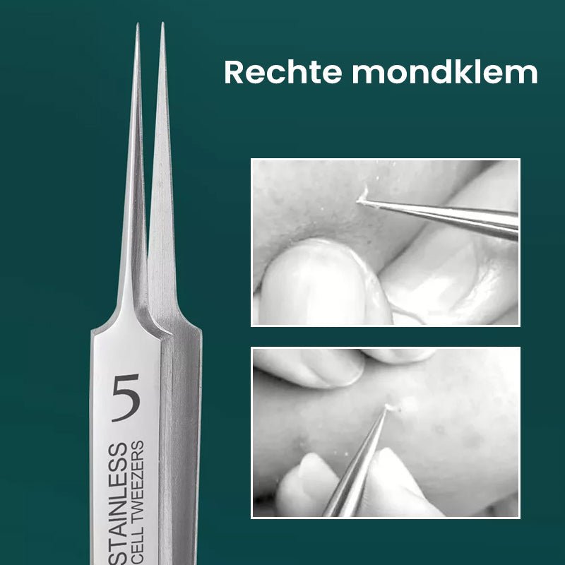 Schönheits-Werkzeugset aus Edelstahl zur Entfernung von Unreinheiten, Pickeln & Mitessern für glatte Haut.