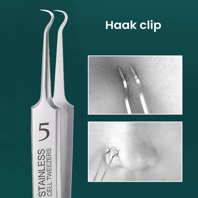 Hygienisches Pickelentferner Set für makellose Haut, reduziert Unreinheiten & fördert klare Gesichtspflege.