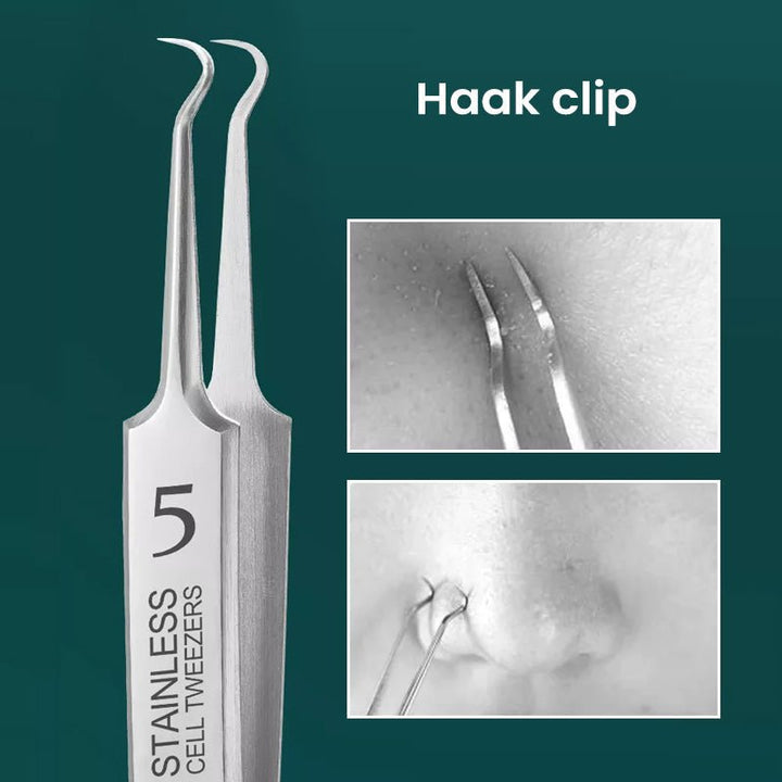 Hygienisches Pickelentferner Set für makellose Haut, reduziert Unreinheiten & fördert klare Gesichtspflege.