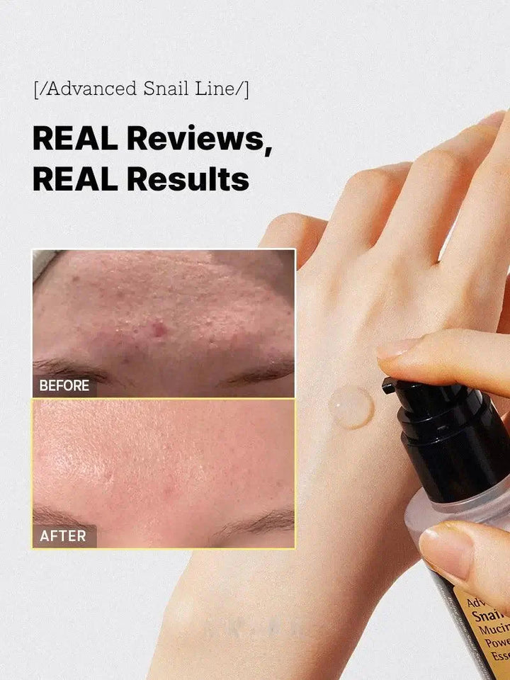 Regenerierendes Snail Mucin Gesichtsserum, reduziert Narben, spendet Feuchtigkeit und macht die Haut glatt.