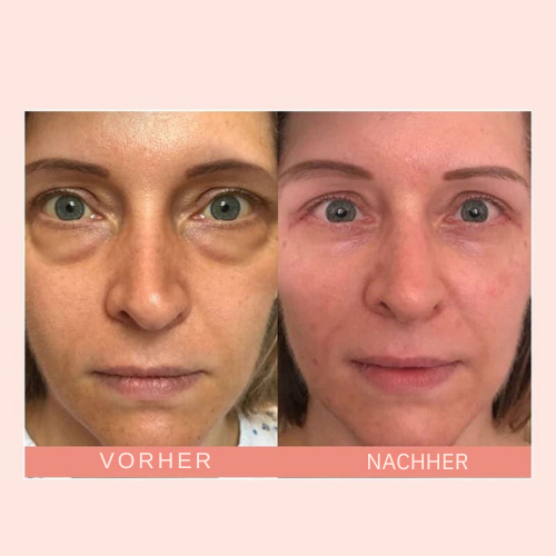 Praktischer Retinol Augencreme Stick für schnelle Anti-Aging Augenpflege unterwegs gegen Falten & Augenringe.