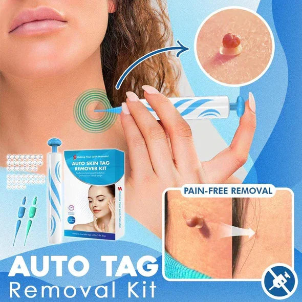 Schmerzfreies Hautanhängsel & Warzen Entferner Kit für einfache und sichere Hautmakelentfernung.