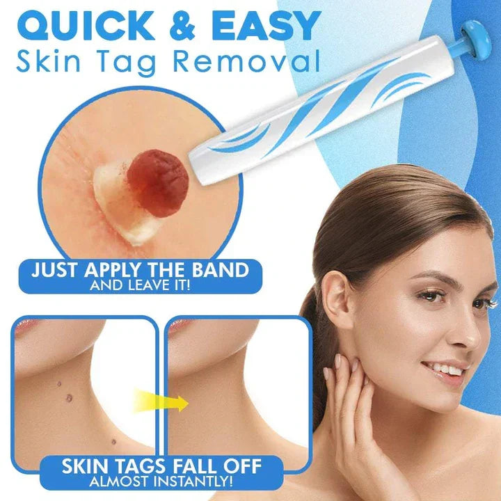 Komplettes Kit zur schmerzfreien Entfernung von Hautanhängseln & Warzen für makellose Haut.
