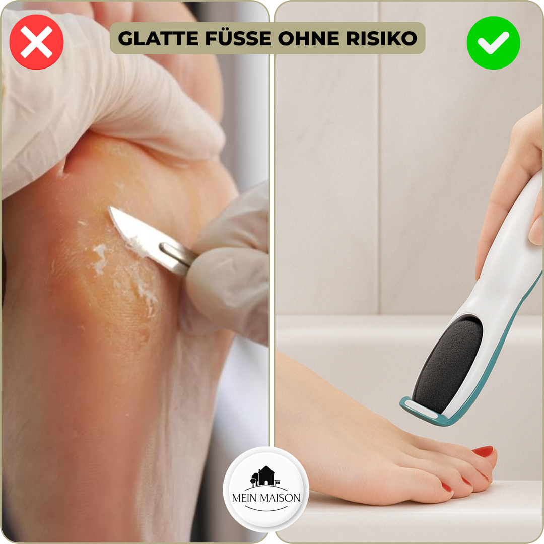 SilkaFeet Pediküregerät wird per USB-Kabel geladen, bereit für flexible & kabellose Körperpflege.