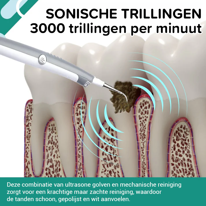 Effektiver SmileFresh Plaque- und Fleckenentferner für optimale Zahnpflege, Mundhygiene und weißere Zähne.