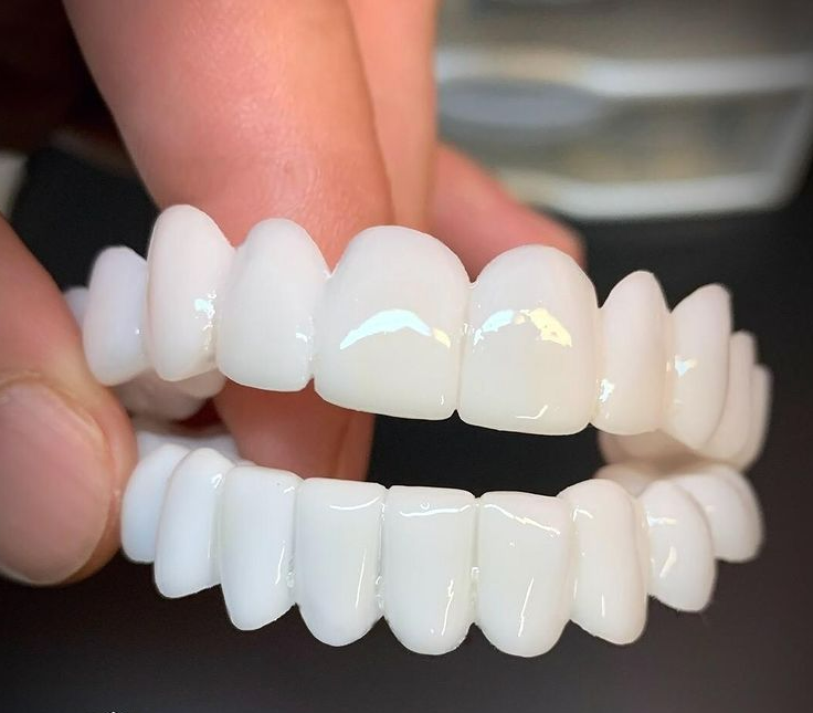 SmileVorm kosmetische Zahnspitzen für ein strahlendes Lächeln, natürlich weiß, flexibel und wiederverwendbar.