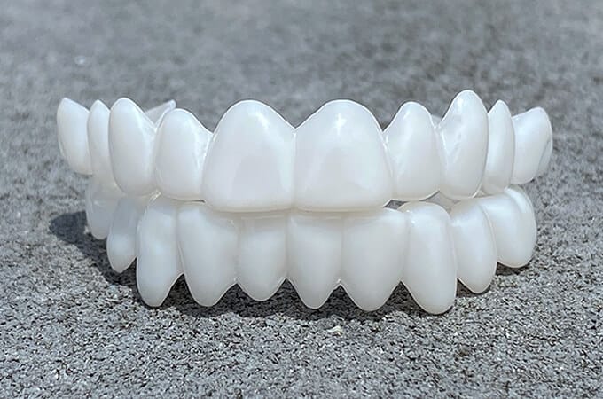 SmileVorm Veneers für ein perfektes, natürlich weißes Lächeln; kaschiert Zahnlücken und Verfärbungen.