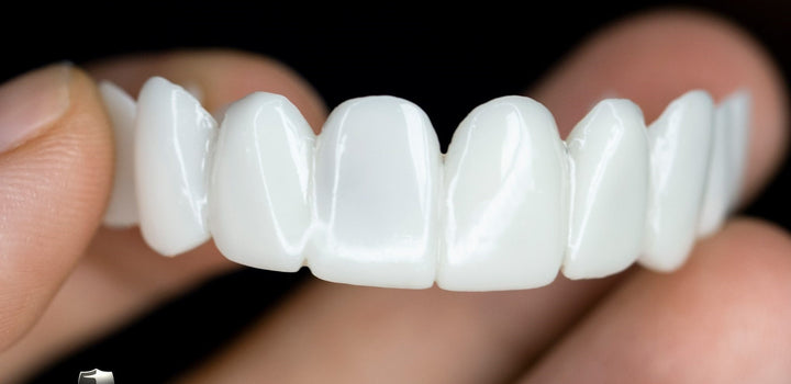 Schneller Zahnersatz mit SmileVorm kosmetischen Zahnspitzen für ein selbstbewusstes, weißes Lächeln.