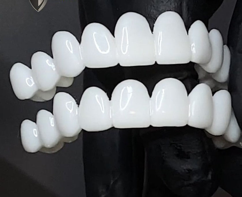 Einfach anzubringende SmileVorm Zahnspitzen, flexibel für angenehmen Tragekomfort; für sofortiges schönes Lächeln.