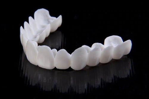 Ästhetische SmileVorm Zahnspitzen in Naturweiß, perfekt für eine schnelle, kosmetische Zahnverschönerung.