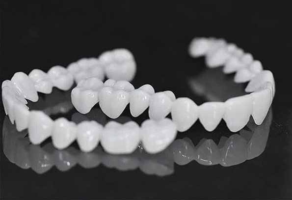 Flexible SmileVorm Veneers für eine temporäre, nicht-invasive Zahnkorrektur; verhilft zu weißeren Zähnen.