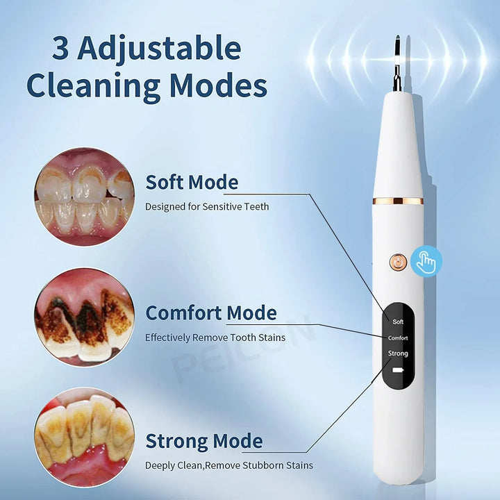 Innovative Ultraschallzahnbürste für gründliche Tiefenreinigung und professionelle Mundpflege.