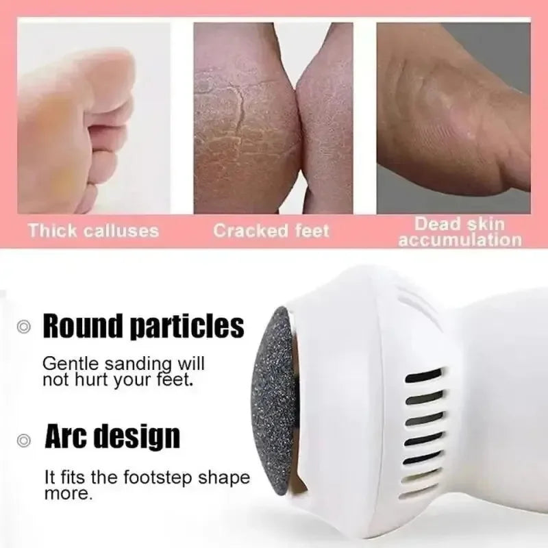 Effektives Gerät zur Hornhautentfernung, perfekt für Unisex-Fußpflege und ein Gefühl von Schönheit.