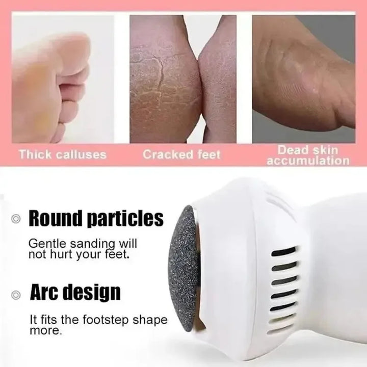 Effektives Gerät zur Hornhautentfernung, perfekt für Unisex-Fußpflege und ein Gefühl von Schönheit.