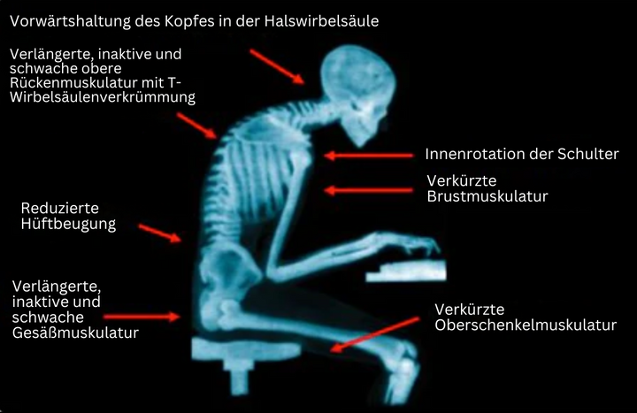 Verstellbarer EMS-Trainer für gesunde Körperhaltung; ideal für Fitness, Wellness & Ergonomie am Arbeitsplatz.