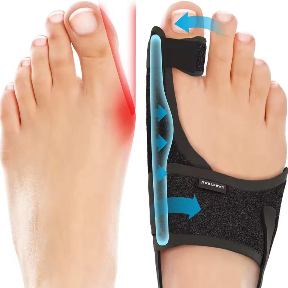 Unisex Nachtschiene für Hallux Valgus zur gezielten Fußkorrektur und Schmerzlinderung für besseres Schlafwohlbefinden.