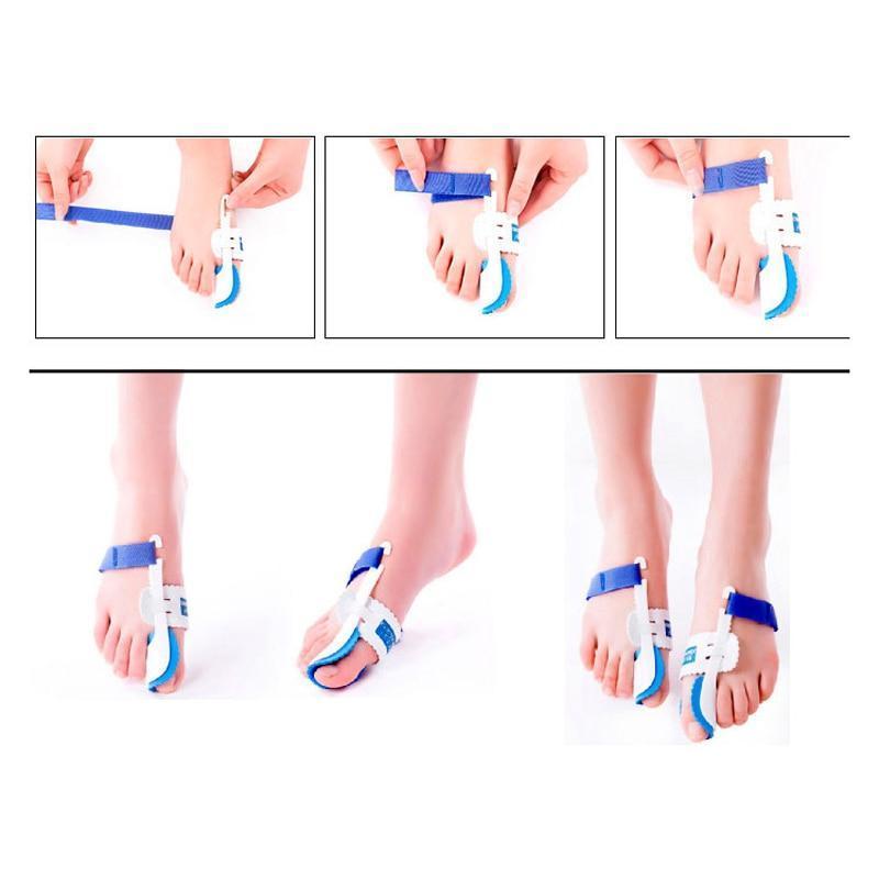 Nachtschiene für Hallux Valgus, verstellbar, bietet orthopädische Unterstützung zur Zehenkorrektur im Schlaf.