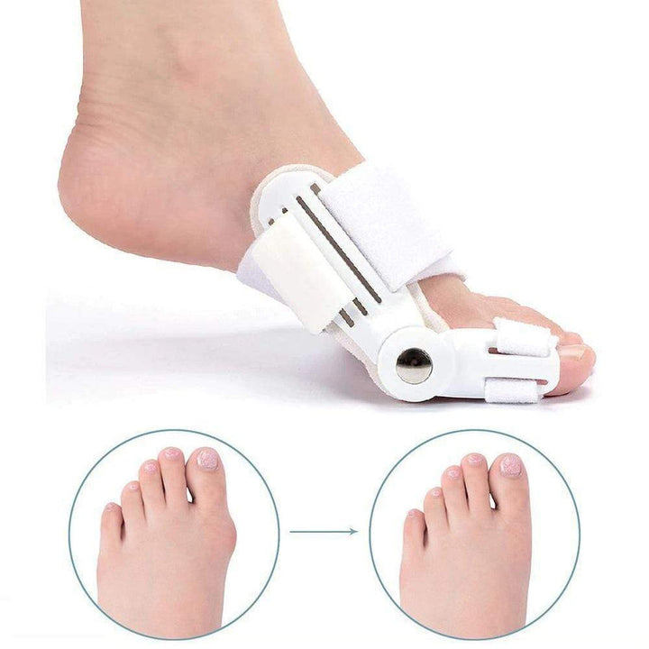 Hallux Valgus Korrekturschiene am Fuß, tagsüber getragen, für sanfte Ballenzeh-Korrektur und Schmerzlinderung.