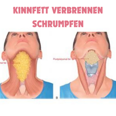 Innovativer Kieferformer für markante Gesichtsprofile & eine jugendlichere Ausstrahlung. Anti-Aging.