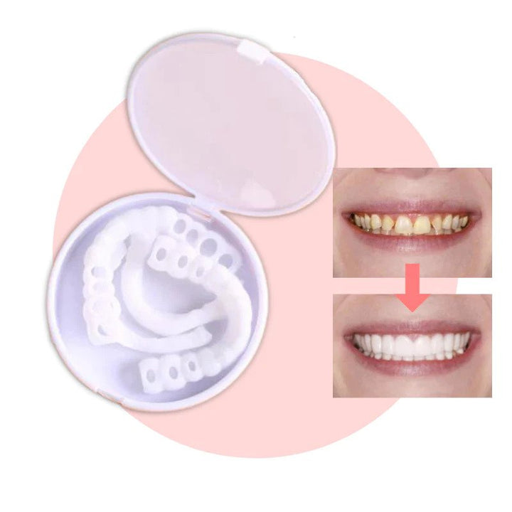 Natürlich aussehende, klebstofffreie Veneers. Flexible Zahnschalen für ein perfektes, strahlendes Lächeln.