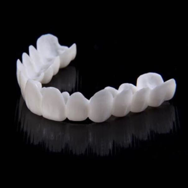 Nahaufnahme der Zahn-Veneers, die unregelmäßige Zähne abdecken und ein ästhetisches Bild schaffen.