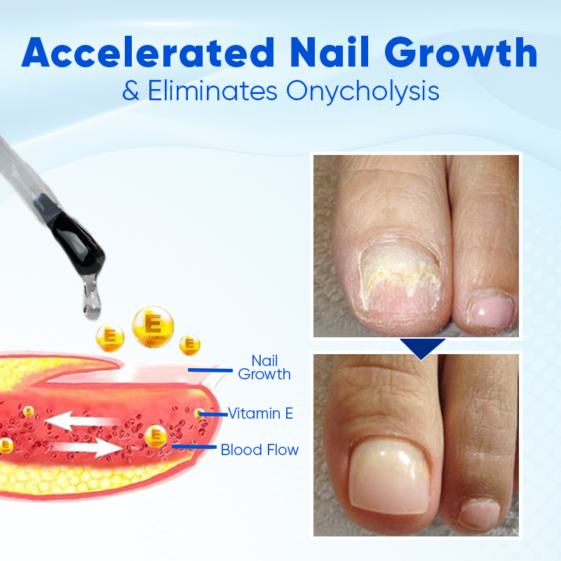 Nahaufnahme des Biotin Nagelserums für schnelles Nagelwachstum. Ideale Nagelpflege für Maniküre zuhause.