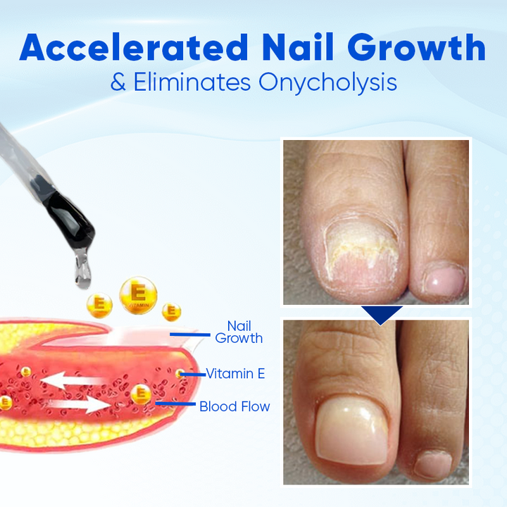 Nahaufnahme des Biotin Nagelserums für schnelles Nagelwachstum. Ideale Nagelpflege für Maniküre zuhause.