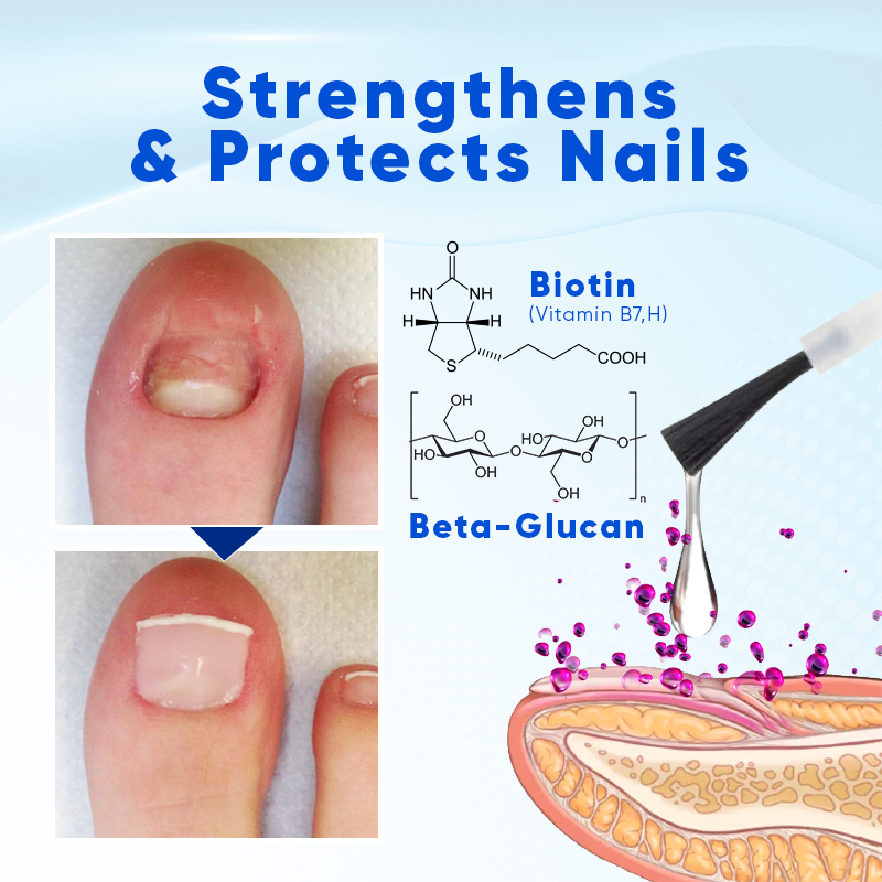 Intensives Nagelserum mit Biotin zur Stärkung brüchiger Nägel, fördert Wachstum und intensive Feuchtigkeitspflege.