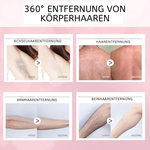Sanftes Haarentfernungsspray für den ganzen Körper; mühelose Haarentfernung für seidige Haut.