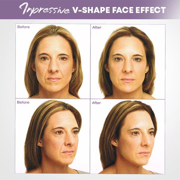 Effektives Anti-Aging Facelifting-Tape für glatte, straffe Haut & sichtbare Faltenreduzierung