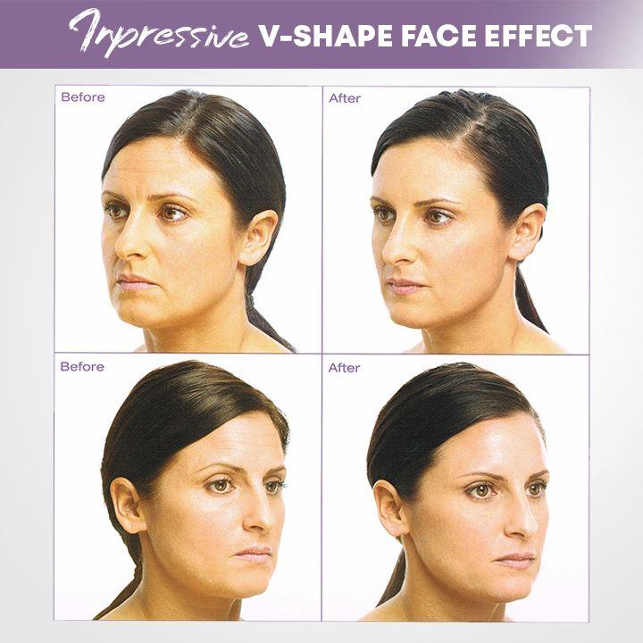 Unsichtbares Gesichtslifting-Klebeband für einen natürlichen, gestrafften Look. Ideal für Beauty & Hautpflege