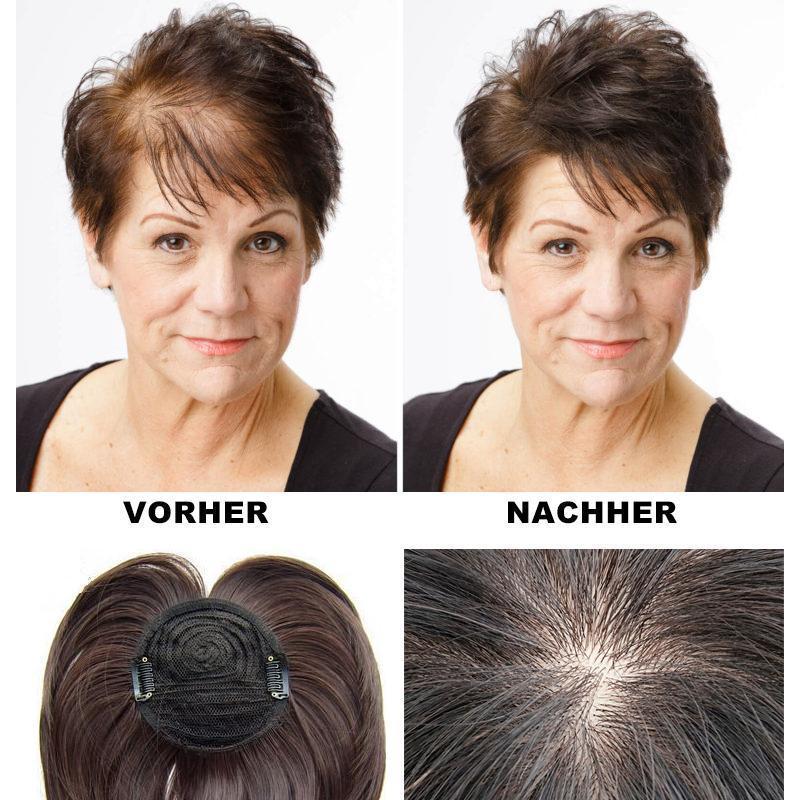 Haarverdichtung Oberkopfhaarteil für sofortiges Volumen und volles Haar.