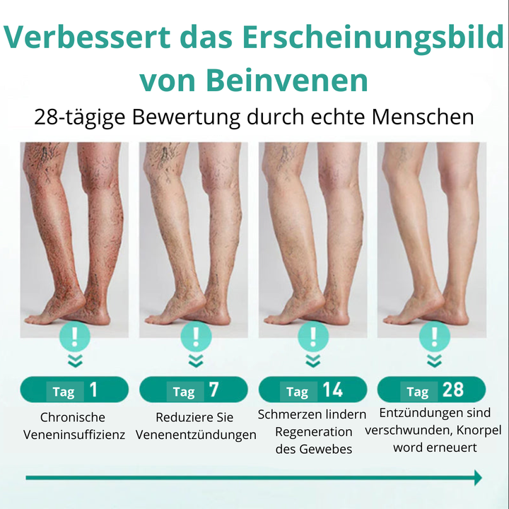 VenoLift Patch am Bein: gezielte Linderung bei Krampfadern, Schwellungen und zur Venenstärkung.