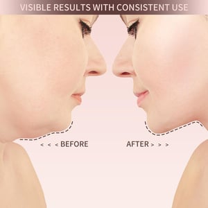 Effektives VitaLift Liftingband für sofortigen Straffungs-Effekt & eine definierte Kinnlinie.