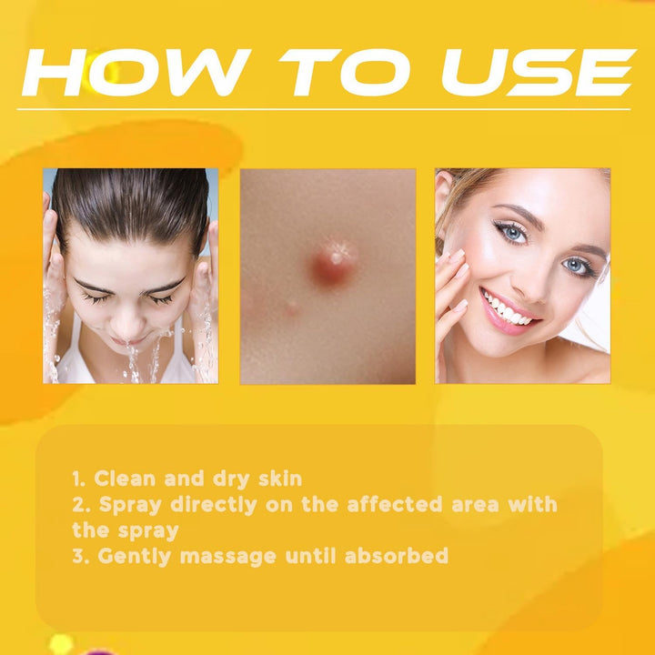 Bienengift-Hautspray zur Entfernung von Warzen, Muttermalen und anderen Hautwucherungen.
