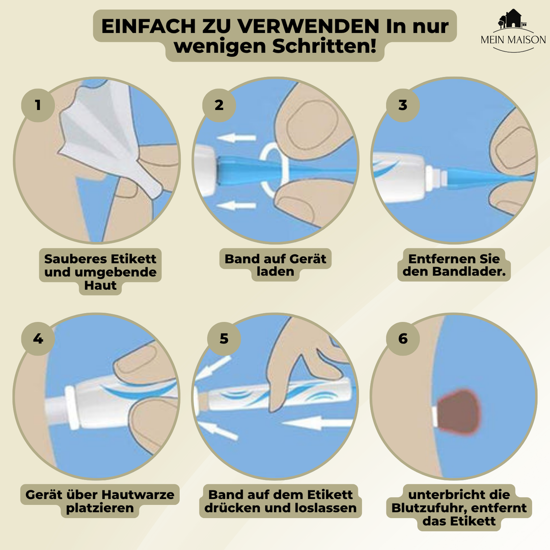 Bequeme Warzenentfernung zu Hause mit dem sicheren und schmerzfreien Muttermal Entferner Gerät.