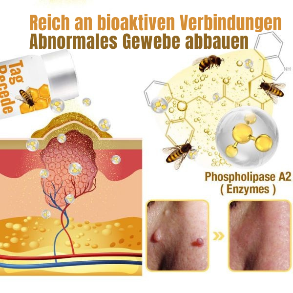 Hautpflege Spray gegen Warzen und Hautunreinheiten; sanfte Formel für glatte Haut ohne Schmerzen.